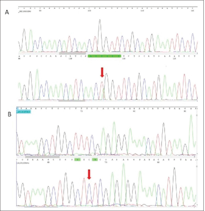 The Prevalence of CHEK1 and CHEK2 Mutations in Prostate Cancer: a Retrospective Cohort Study.