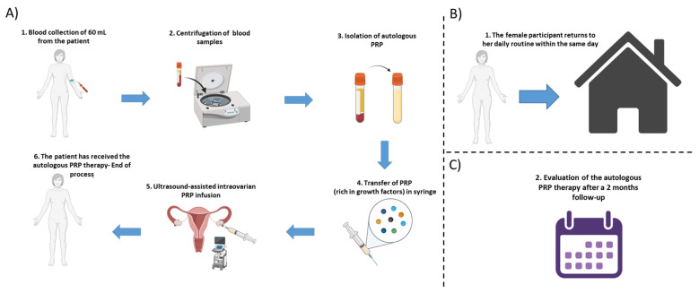 Clinical Benefit of Autologous Platelet-Rich Plasma Infusion in Ovarian Function Rejuvenation: Evidence from a Before-After Prospective Pilot Study.