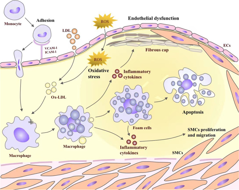 Anti-inflammatory therapy of atherosclerosis: focusing on IKKβ.