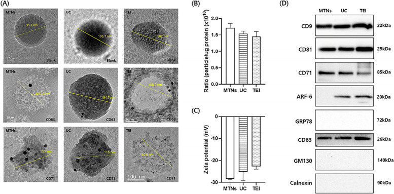 Magnetic transferrin nanoparticles (MTNs) assay as a novel isolation approach for exosomal biomarkers in neurological diseases.