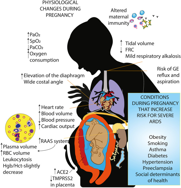 Pregnancy and Severe ARDS with COVID-19: Epidemiology, Diagnosis, Outcomes and Treatment