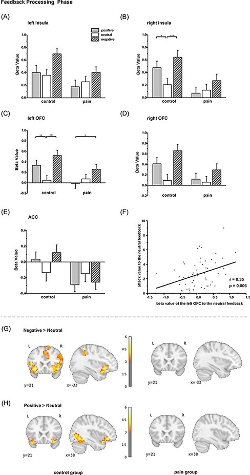 Incidental physical pain reduces brain activities associated with affective social feedback and increases aggression.