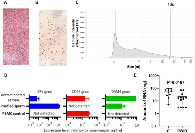 Men who inject opioids exhibit altered tRNA-Gly-GCC isoforms in semen.