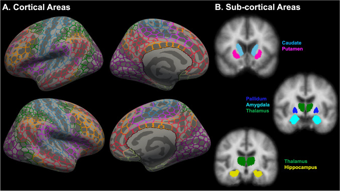 Machine learning based identification of structural brain alterations underlying suicide risk in adolescents.