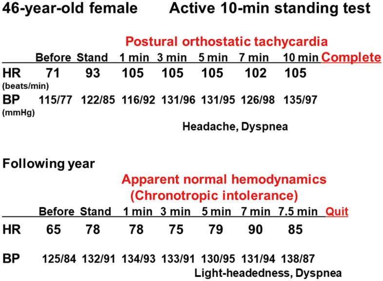 Orthostatic Intolerance and Chronotropic Incompetence in Patients With Myalgic Encephalomyelitis or Chronic Fatigue Syndrome.