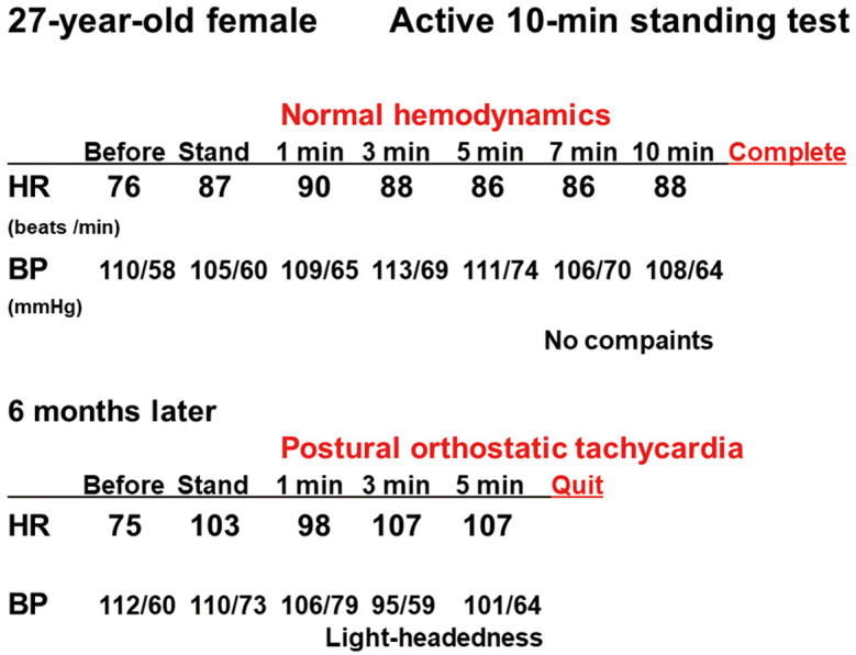 Orthostatic Intolerance and Chronotropic Incompetence in Patients With Myalgic Encephalomyelitis or Chronic Fatigue Syndrome.