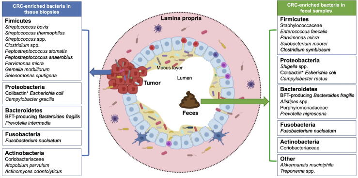 Gut Microbiome in Colorectal Cancer: Clinical Diagnosis and Treatment