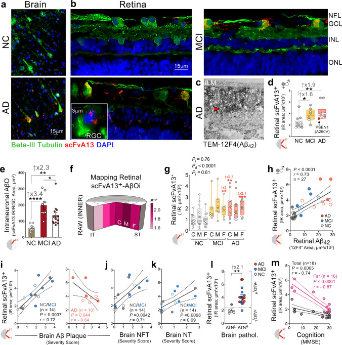 Retinal pathological features and proteome signatures of Alzheimer’s disease