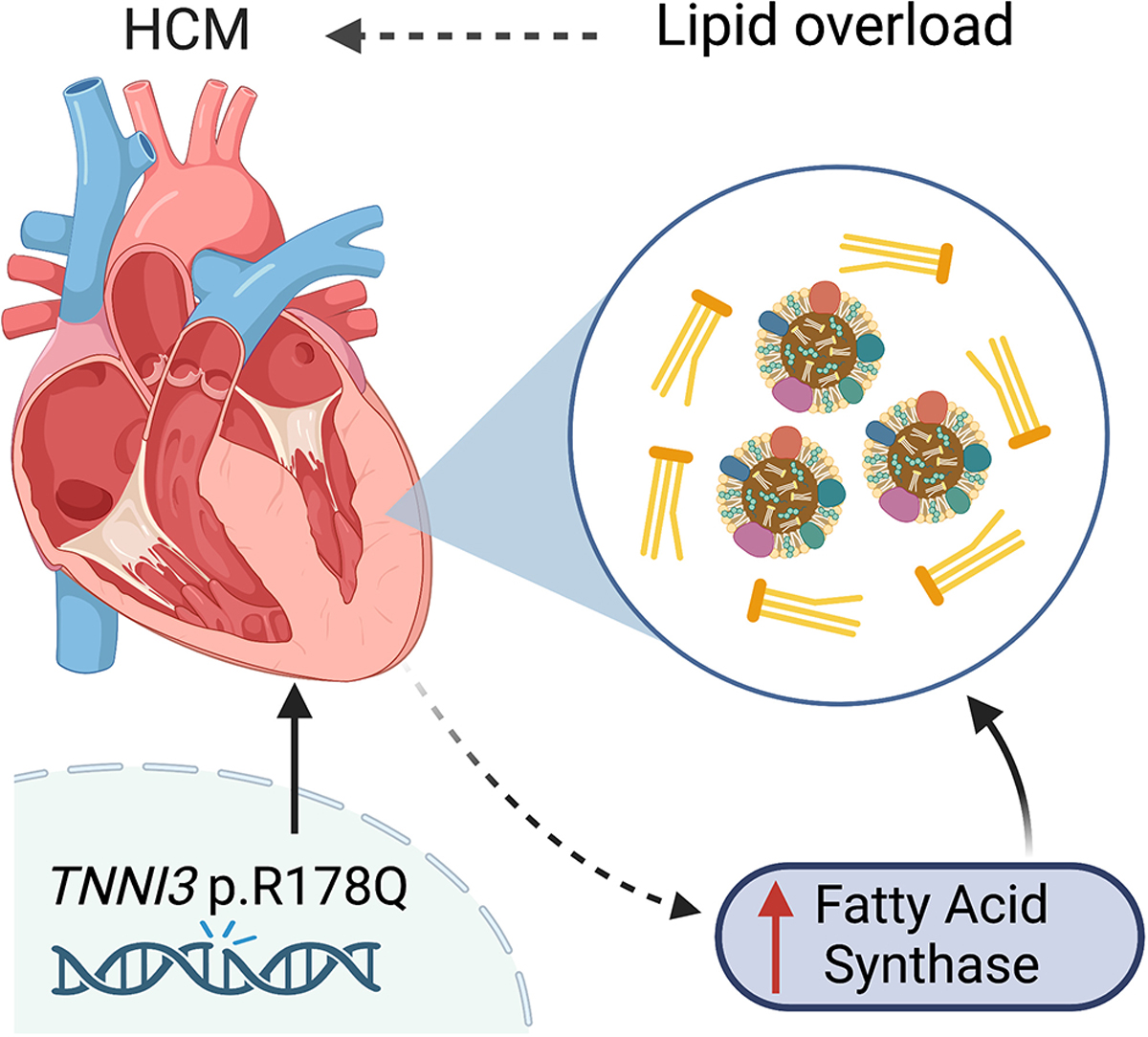 Lipid overload - a culprit for hypertrophic cardiomyopathy?