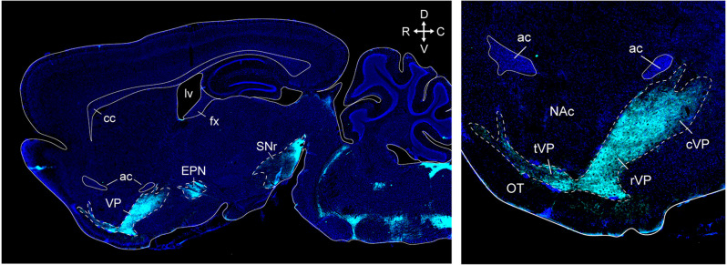 Ventral pallidal regulation of motivated behaviors and reinforcement.