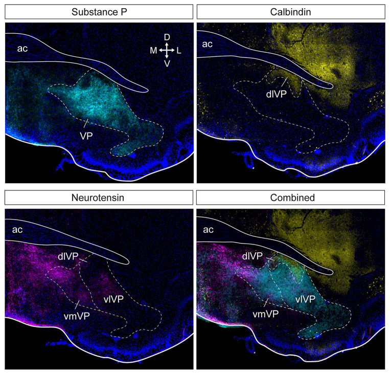 Ventral pallidal regulation of motivated behaviors and reinforcement.