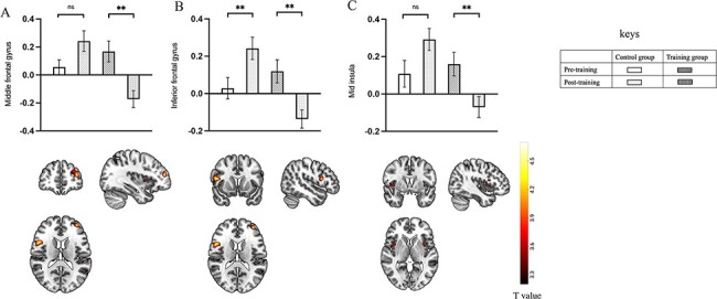 Pilot study of food-specific go/no-go training for overweight individuals: brain imaging data suggest inhibition shapes food evaluation.