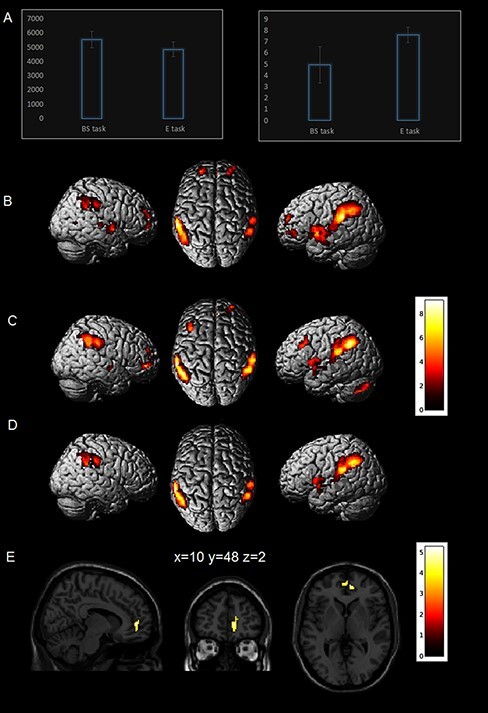 Attention to the other's body sensations modulates the ventromedial prefrontal cortex.