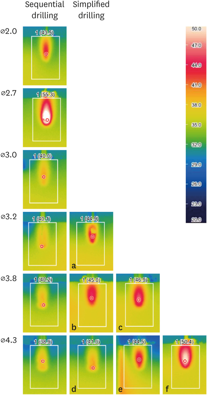 Effects of a simplified drilling protocol at 50 rpm on heat generation under water-free conditions: an <i>in vitro</i> study.