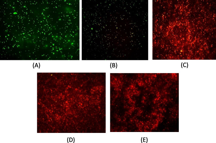 A novel anti-lipopolysaccharide factor from blue swimmer crab Portunus pelagicus and its cytotoxic effect on the prokaryotic expression host, E. coli on heterologous expression.