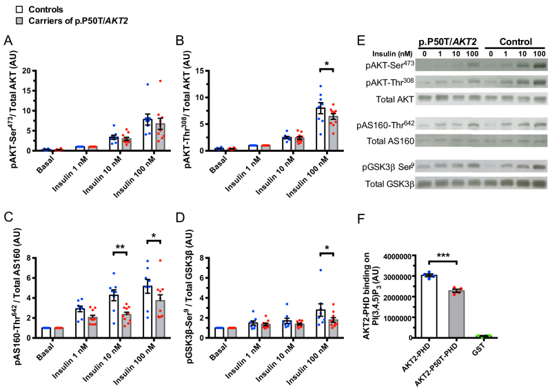 Finnish-specific AKT2 gene variant leads to impaired insulin signalling in myotubes.