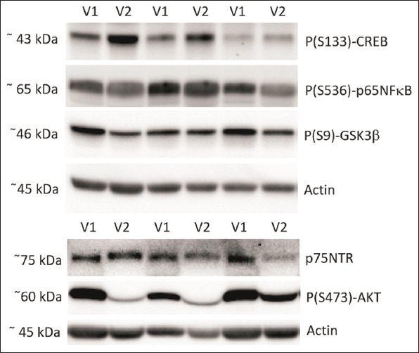 <i>Bacopa monnieri</i> supplementation has no effect on serum brain-derived neurotrophic factor levels but beneficially modulates nuclear factor kappa B and cyclic AMP response element-binding protein levels in healthy elderly subjects.