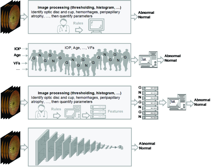 Clinical Applications of Artificial Intelligence in Glaucoma.