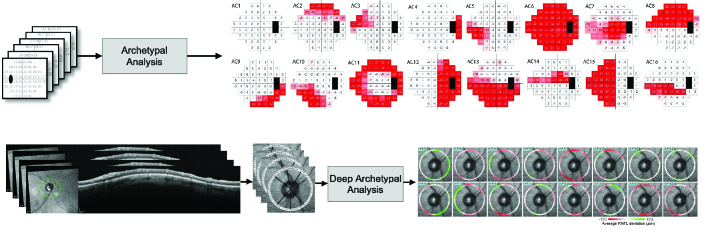 Clinical Applications of Artificial Intelligence in Glaucoma.