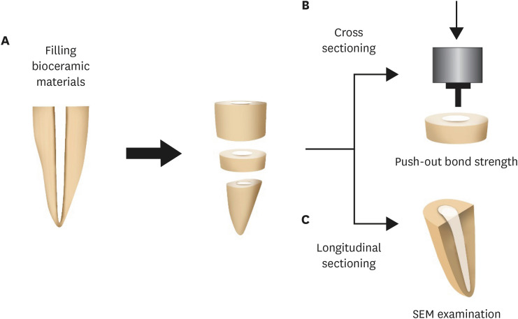 Push-out bond strength and intratubular biomineralization of a hydraulic root-end filling material premixed with dimethyl sulfoxide as a vehicle.