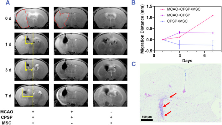 Metal protoporphyrin-induced self-assembly nanoprobe enabling precise tracking and antioxidant protection of stem cells for ischemic stroke therapy.