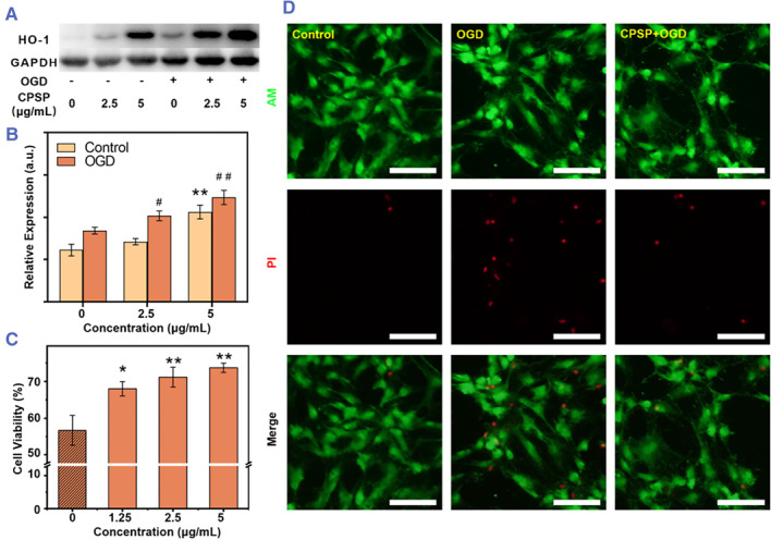 Metal protoporphyrin-induced self-assembly nanoprobe enabling precise tracking and antioxidant protection of stem cells for ischemic stroke therapy.