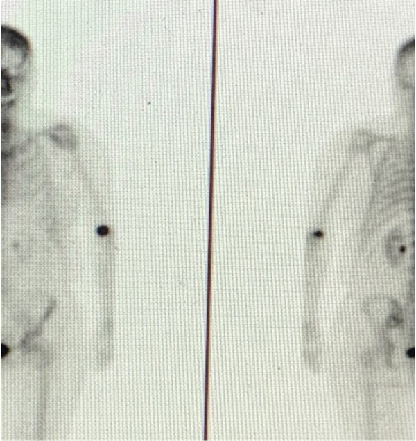 Transparency - a patient-centric view on radiopharmaceutical extravasations.