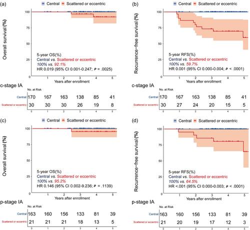 Ground glass nodules with scattered or eccentric island-shaped consolidations may have poor outcomes