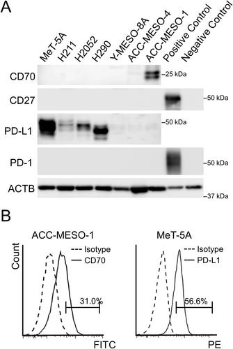 CD70 and PD-L1 (CD274) co-expression predicts poor clinical outcomes in patients with pleural mesothelioma