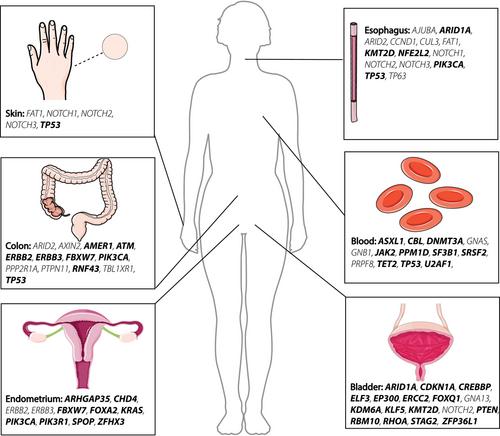 The etiology of clonal mosaicism in human aging and disease