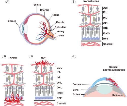 Antiangiogenic therapy for ocular diseases: Current status and challenges