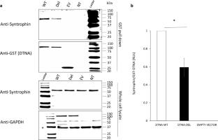 Variants in DTNA cause a mild, dominantly inherited muscular dystrophy