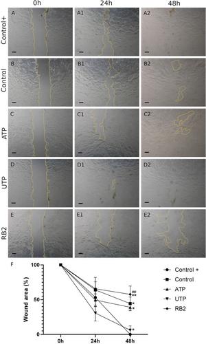 UTP increases wound healing in the self assembled skin substitute (SASS)