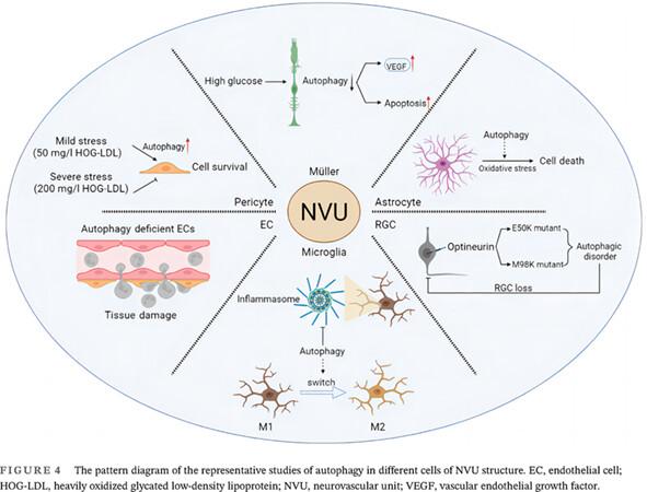 Autophagy in the retinal neurovascular unit: New perspectives into diabetic retinopathy
      视网膜神经血管单元自噬:糖尿病视网膜病变的新视角