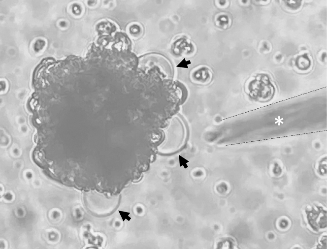 Proteoliposomes reconstituted with human aquaporin-1 reveal novel single-ion-channel properties.