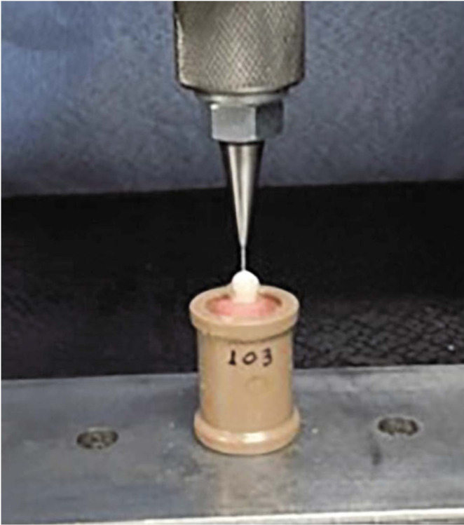 Effect of cone-beam computed tomography metal artefact reduction on incomplete subtle vertical root fractures.