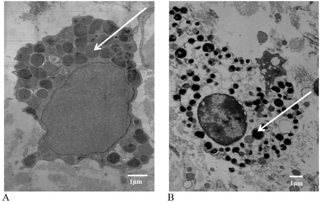 The Role of Leukotriene B<sub>4</sub> in Cow Metritis.