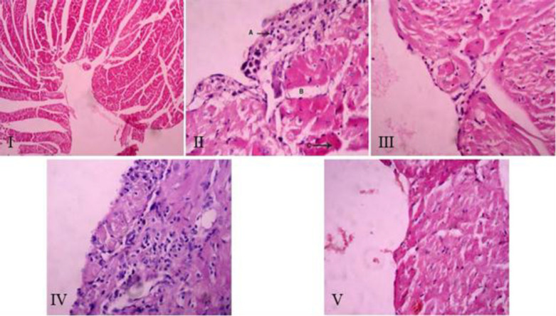 Effect of hydro-alcoholic extract of <i>Panax ginseng</i> and Ampicillin treatment in an animal model of <i>Listeria monocytogenes</i>-induced endocarditis.