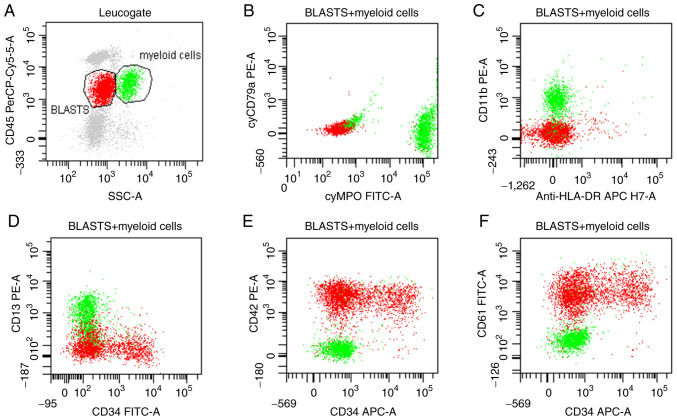 t(1;7;22)(p13;q21;q13) is a novel 3-way variant of t(1;22)(p13;q13) neonatal acute megakaryoblastic leukemia: A case report.