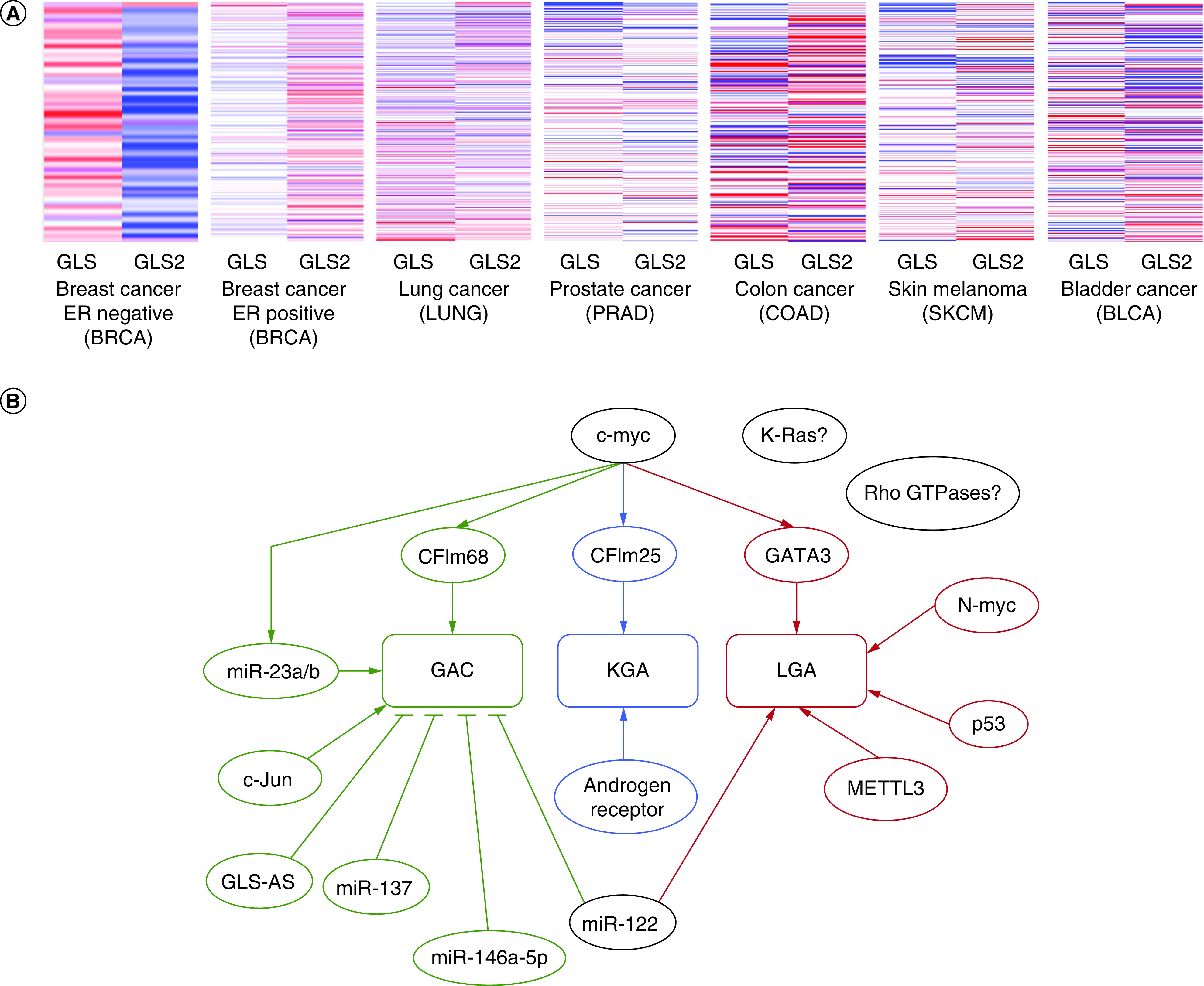 Alone and together: current approaches to targeting glutaminase enzymes as part of anti-cancer therapies.