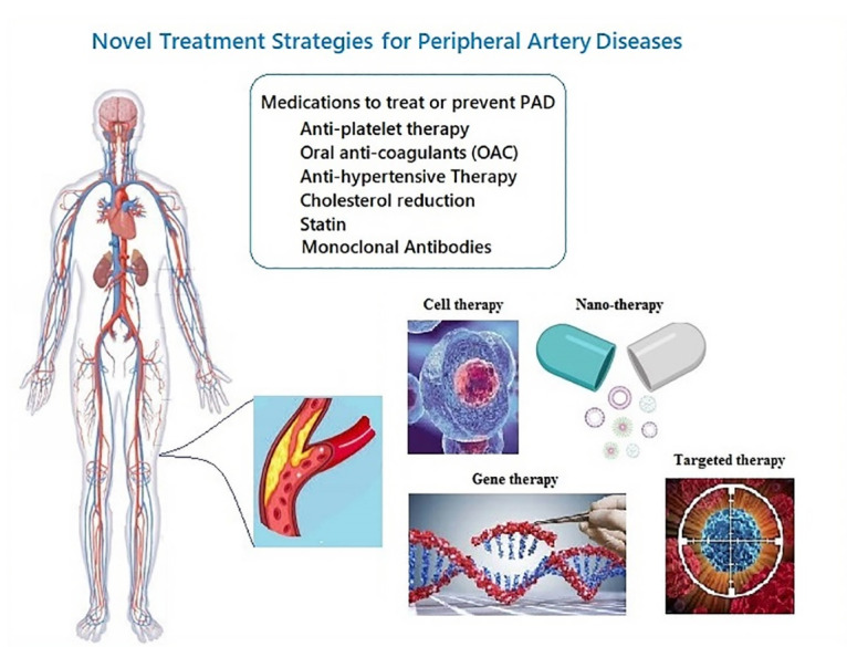 Current and Novel Emerging Medical Therapies for Peripheral Artery Disease: A Literature Review.