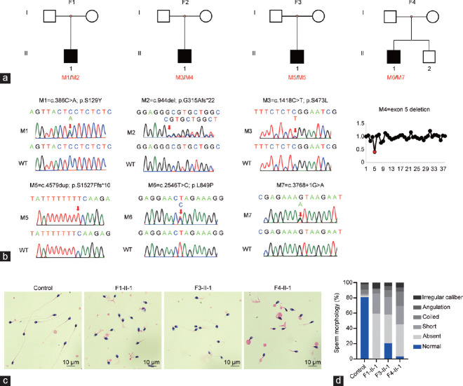 Patients with MMAF induced by novel biallelic CFAP43 mutations have good fertility outcomes after intracytoplasmic sperm injection.