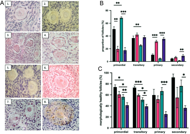 The ovaries of transgender men indicate effects of high dose testosterone on the primordial and early growing follicle pool.