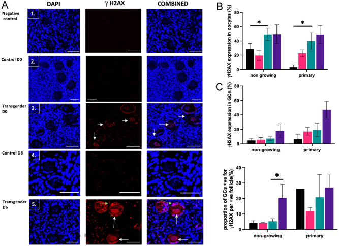 The ovaries of transgender men indicate effects of high dose testosterone on the primordial and early growing follicle pool.