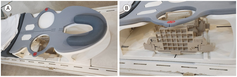 [MRI-Guided Breast Intervention: Biopsy and Needle Localization].