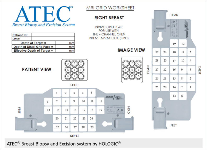 [MRI-Guided Breast Intervention: Biopsy and Needle Localization].