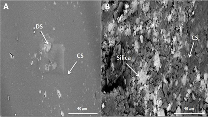 Controlled release of silica-coated insulin-loaded chitosan nanoparticles as a promising oral administration system.