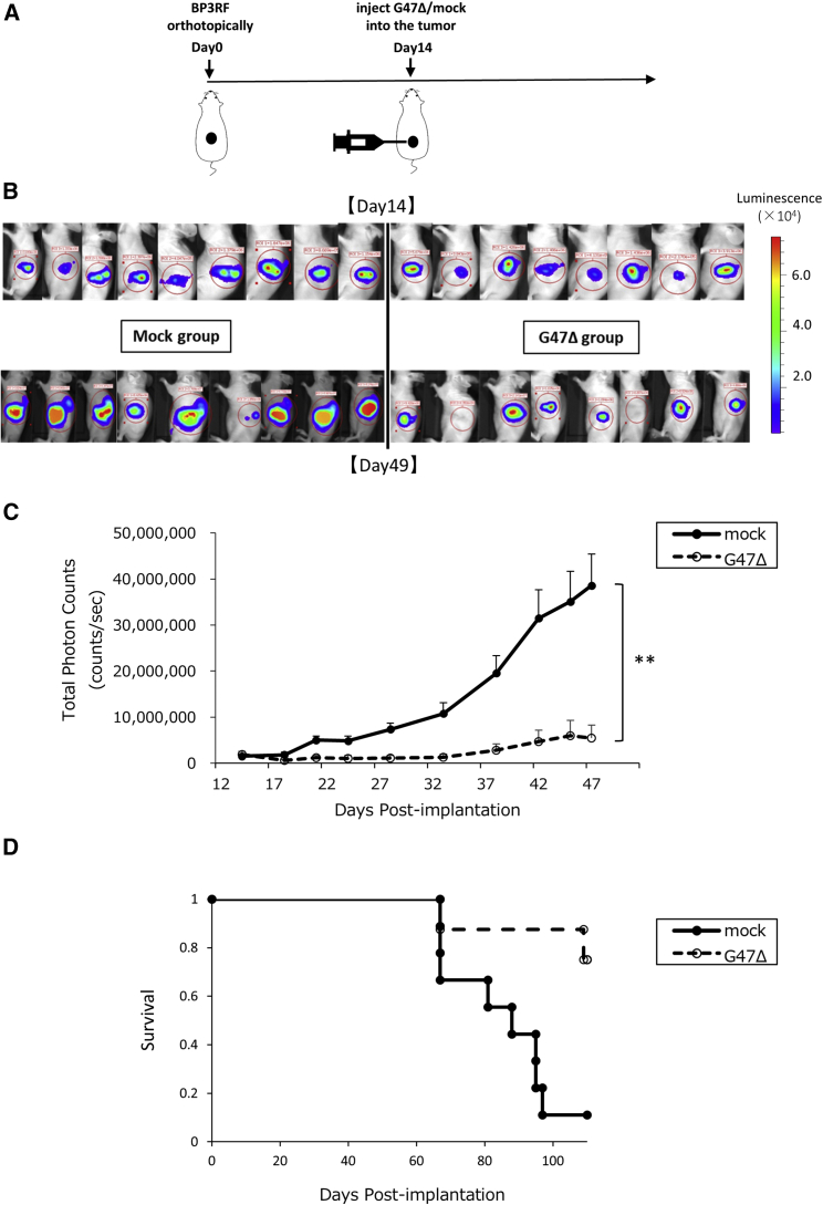 Overcoming resistance of stroma-rich pancreatic cancer with focal adhesion kinase inhibitor combined with G47Δ and immune checkpoint inhibitors.