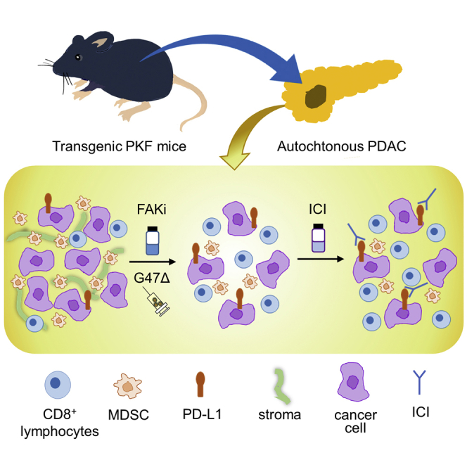 Overcoming resistance of stroma-rich pancreatic cancer with focal adhesion kinase inhibitor combined with G47Δ and immune checkpoint inhibitors.