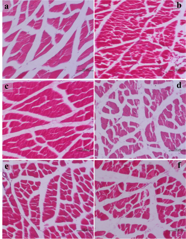 The toxic effects of anabolic steroids "nandrolone decanoate" on cardiac and skeletal muscles with the potential ameliorative effects of silymarin and fenugreek seeds extract in adult male albino rats.